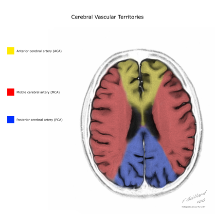 MAP VASCULAR TERRITORIES | hubstroke.com